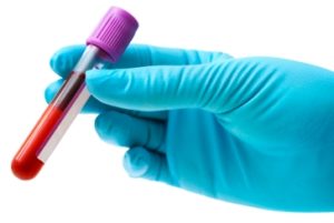 blood filled test tube
